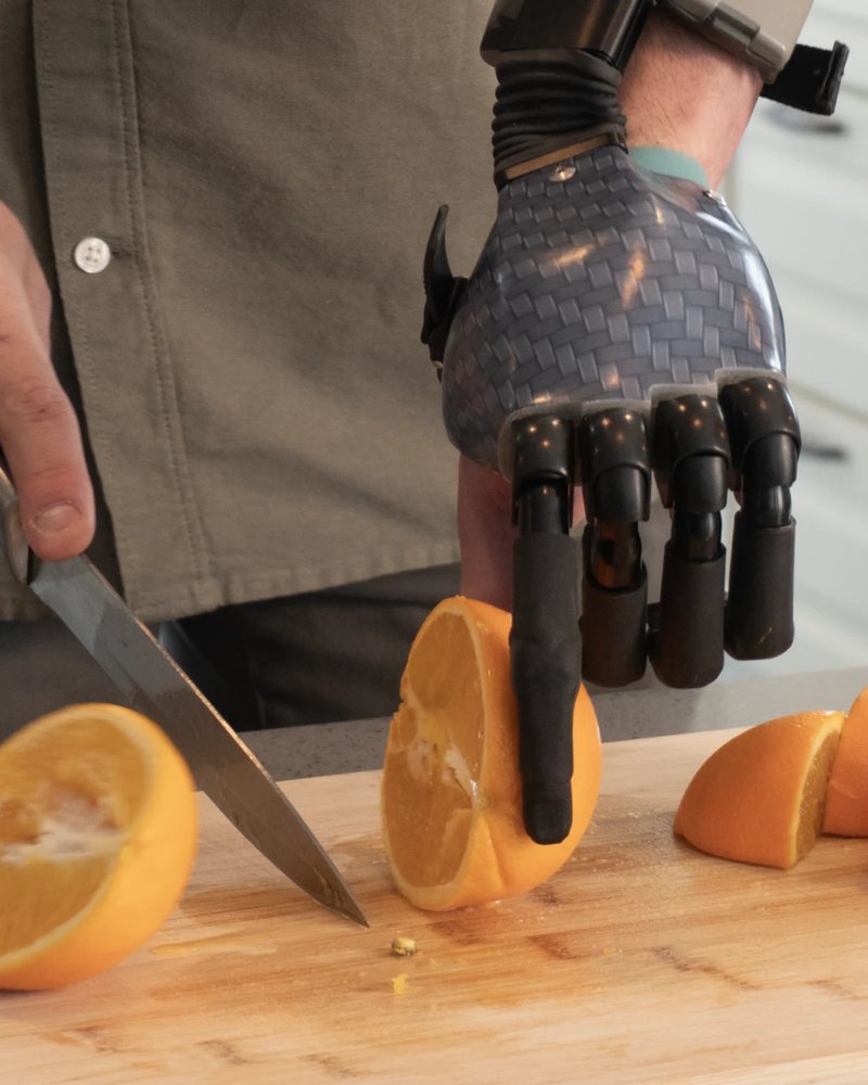 A multi-articulating bionic partial-hand prosthesis gripping a knife to slice fruit.