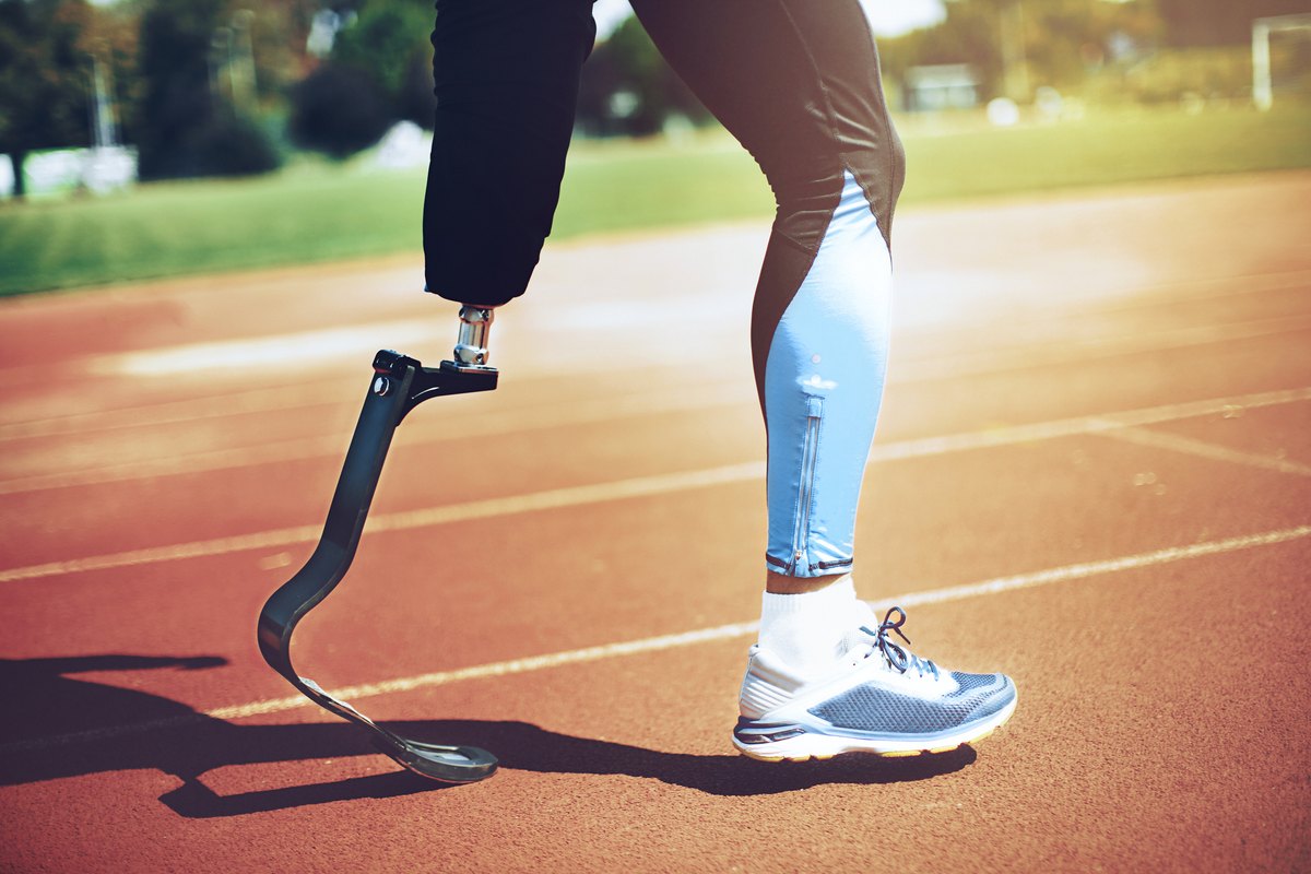 Active prosthetic user on a running track &mdash; the kind of patient Limber&rsquo;s lighter printed sockets are built for.