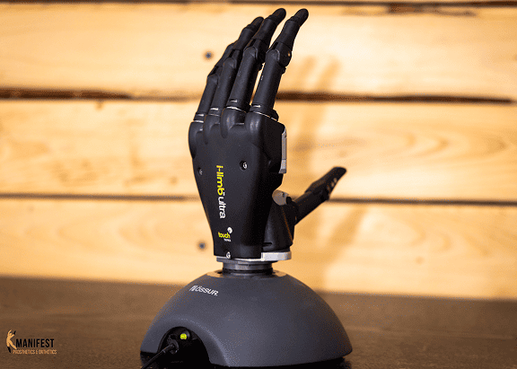 i-Limb Ultra myoelectric prosthetic hand on display.